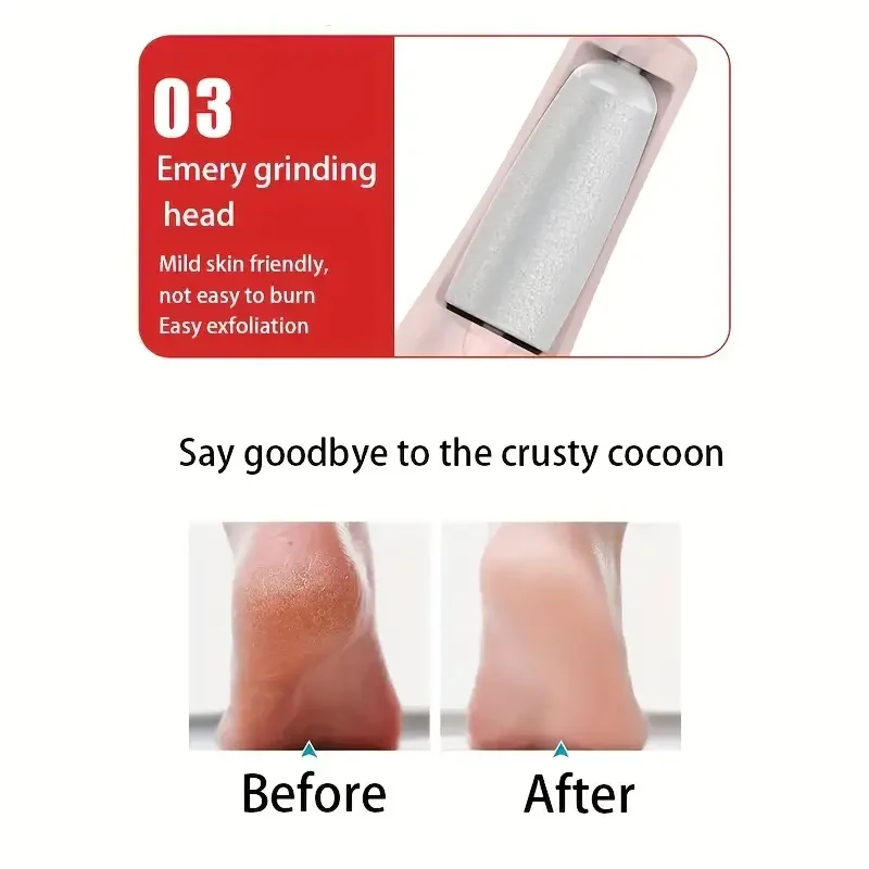 Foot Rough Patch Removal